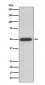 ATPB Antibody