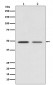 Vitamin D Receptor Antibody