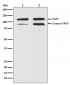 PARP Antibody