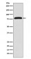 TGM2 Antibody