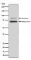 PCSK9 Antibody