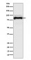 TGF beta Receptor II Antibody