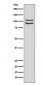 FGFR4 Antibody