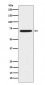 ZAP70 Antibody