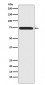 Menin Antibody