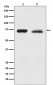 NF2 / Merlin Antibody