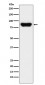 Prothrombin Antibody