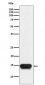 FABP3 Antibody