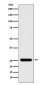 Peroxiredoxin 3 Antibody