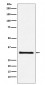 GC1q R Antibody