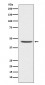 CCR8 Antibody