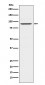 Prolactin Receptor Antibody