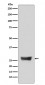 NDUFS3 Antibody