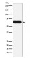 Placental alkaline phosphatase (PLAP) Antibody