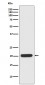 Ferritin Heavy Chain Antibody