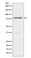 Insulin Receptor R Antibody