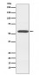 Cytochrome P450 2D6 Antibody