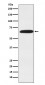 DDX5 Antibody 