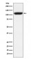 TRPM8 Antibody 