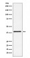 CTLA4 (CD152) Antibody 