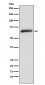 USP22 Antibody 