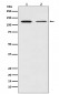 NF-κB p100/p52 Antibody 