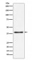 Aspartate Aminotransferase Antibody 