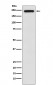 TRPM7 Antibody