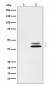 Phospho-ERK1 (T202) + ERK2 (T185) Antibody