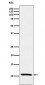 Estrogen Inducible Protein pS2 Antibody