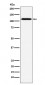 CD30 Antibody