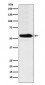 FTO Antibody