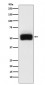 MMP17 Antibody