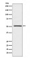 NR0B1 / DAX1 Antibody