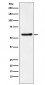 DKC1 Antibody