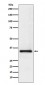 U1A Antibody