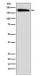 SMARCC1/BAF155 Antibody