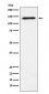 RNA Helicase A Antibody