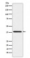 SAE1 Antibody