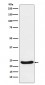 UQCRFS1 Antibody