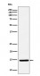 CDKN2A/p14ARF Antibody