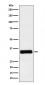 IGFBP2 Antibody