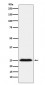 BAP31 Antibody