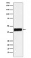 Creatine kinase B type Antibody