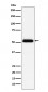 Prostatic Acid Phosphatase Antibody