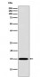 Galectin 7 Antibody