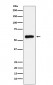 ALDH2 Antibody