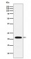 CBFb Antibody