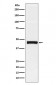 Pentraxin 3 Antibody