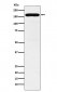 DIAPH1 Antibody